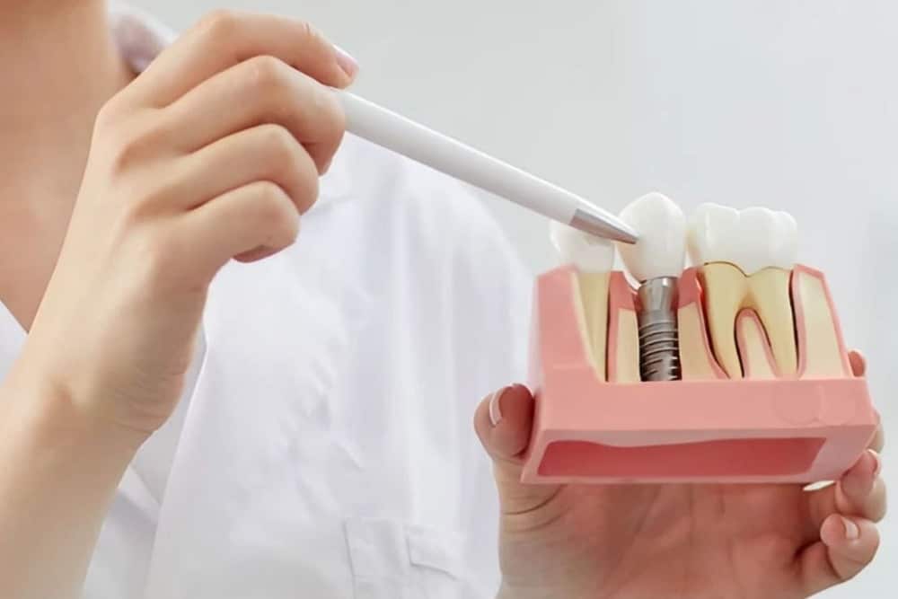 dentista explicando que son los implantes dentales