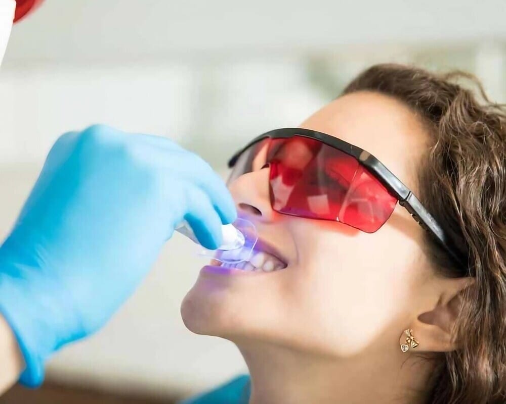 mujer se hace tratamiento luz para dientes blancos