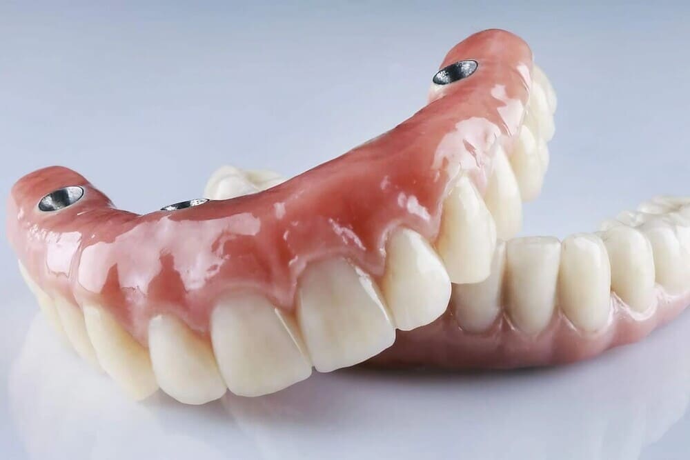 modelo prótesis dental sobre fondo blanco