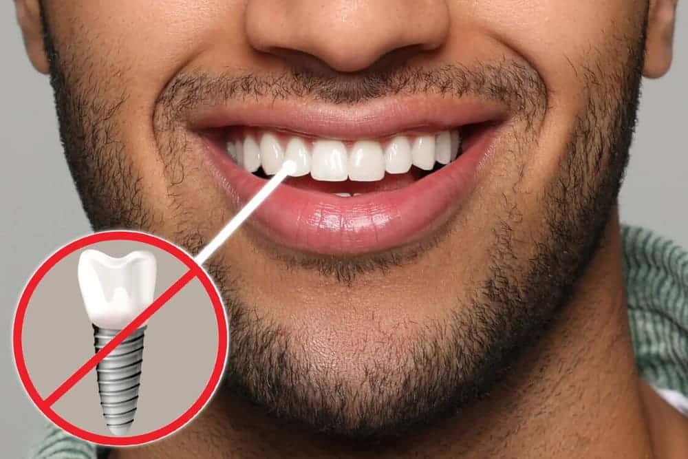 Implantes dentales sin tornillo
